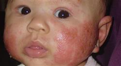 diplomado actualización en patología de los anejos cutáneos para dermatólogos