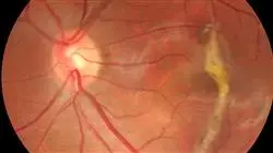 estudiar anatomia fisiologia pruebas exploratorias funcionales macula retina vitreo