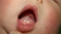 ##IMAGE##