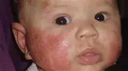 ##IMAGE##