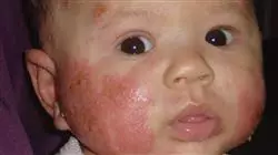 ##IMAGE##