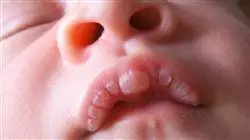 ##IMAGE##