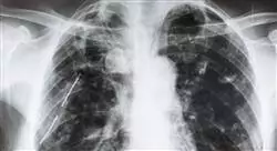 diplomado online urgencias cardiovasculares y del aparato respiratorio en el medio extrahospitalario para médicos