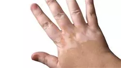 ##IMAGE##