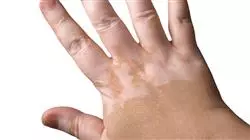 ##IMAGE##