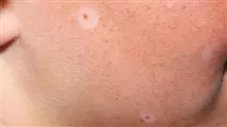##IMAGE##