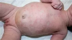 ##IMAGE##