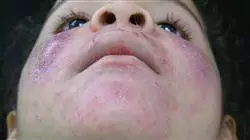 ##IMAGE##