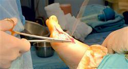 experto universitario cirugía ortopédica y traumatología de rodilla tobillo y pie