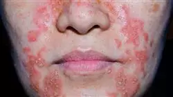 ##IMAGE##