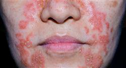 experto universitario fitoterapia dermatológica y otras aplicaciones de la fitoterapia