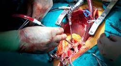 experto universitario manejo actual en patología infecciosa y trasplante en medicina intensiva