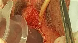 ##IMAGE##