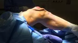 ##IMAGE##