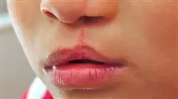 ##IMAGE##