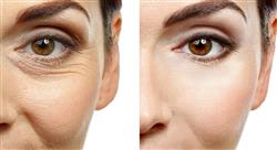 curso online experto cirugia rinofacial Tech Universidad
