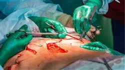 especializacion online cirugia remodelacion corporal