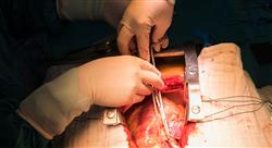 formacion cirugia plastica reconstructiva trax abdomen Tech Universidad