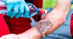 diplomado tratamientos reconstructivos piel quemaduras Tech Universidad