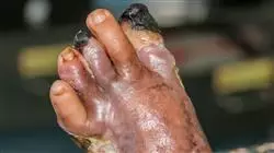##IMAGE##