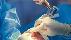 posgrado cirugia estetica nasal Tech Universidad
