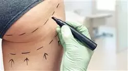 ##IMAGE##