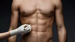 ##IMAGE##
