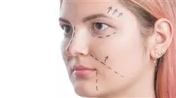 curso online cirugia rejuvenecimiento facial Tech Universidad