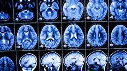 diplomado online trauma medicina intensiva