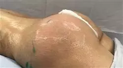##IMAGE##