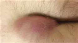 ##IMAGE##
