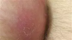 ##IMAGE##