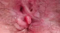 ##IMAGE##