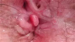 ##IMAGE##