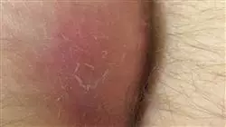 ##IMAGE##