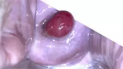 ##IMAGE##