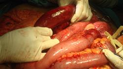 capacitacion practica oncologia digestiva siete