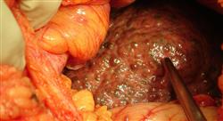 oncologia digestiva cuatro