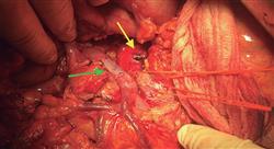 oncologia digestiva tres