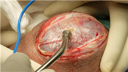 curso capacitacion practica actualizacion cirugia urologicaa