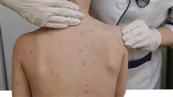 ##IMAGE##