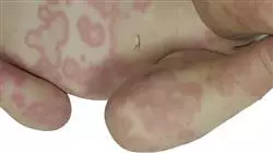 ##IMAGE##
