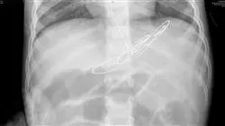 especializacion online patologia hepatica cancer digestivo pediatria