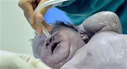 master gastroenterologia hepatologia pediatrica siete