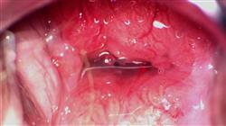 master semipresencial ginecologia oncologica uno