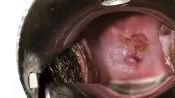##IMAGE##
