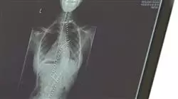##IMAGE##