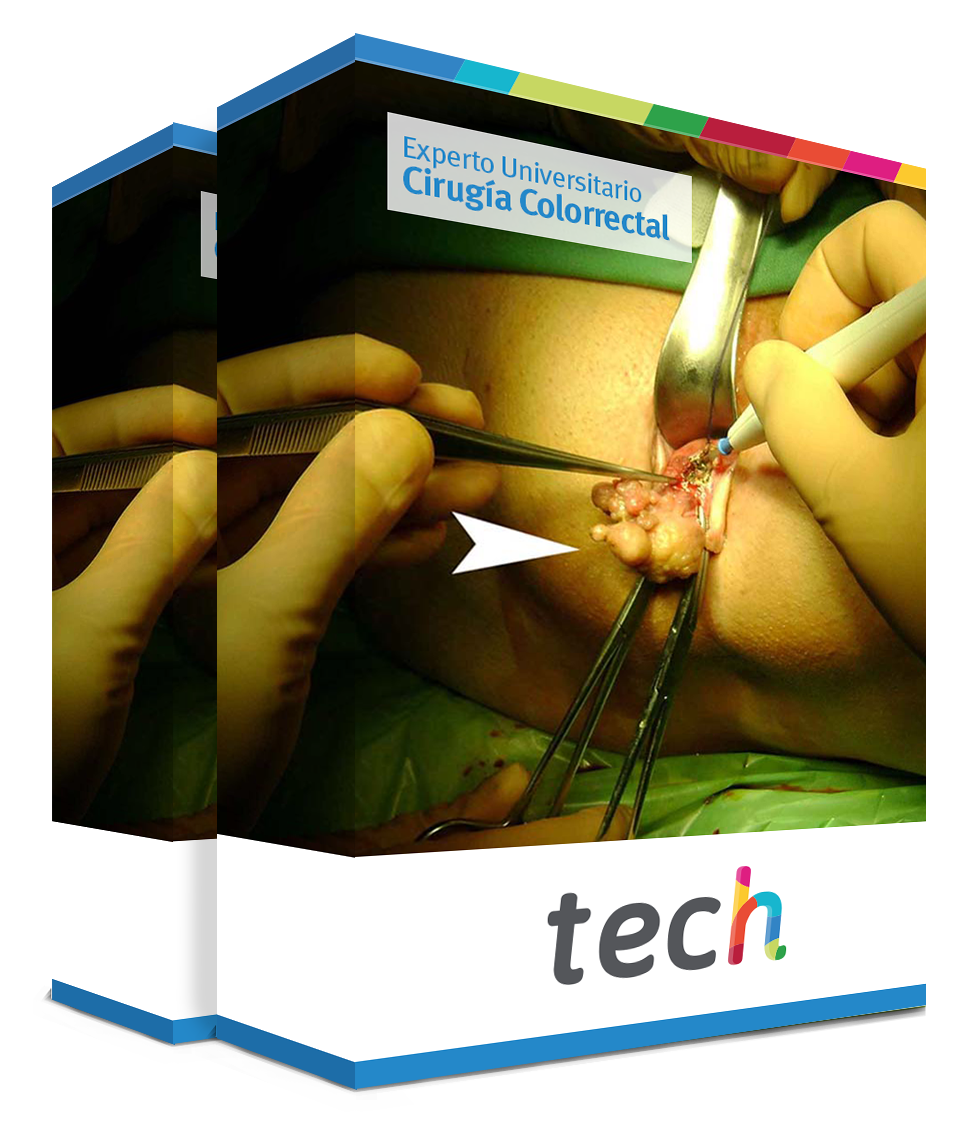 especializacion cirugia colorrectal caja
