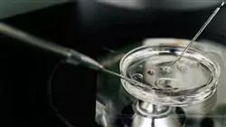 especializacion online preservacion fertilidad indicaciones tecnicas criobiologia