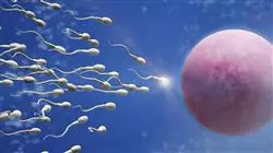 ##IMAGE##